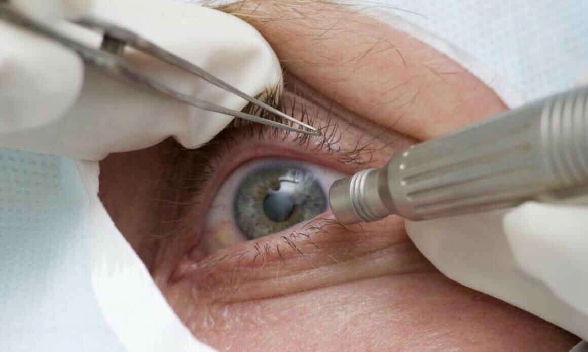 Número de exames oftalmológicos no SUS dobra em relação a 2020